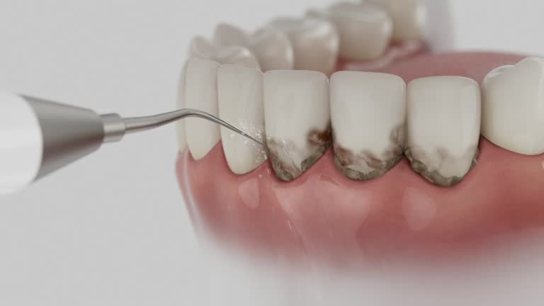 Trusted Teeth Cleaning And Checkup service in Delphi, IN - Dentist Open Now